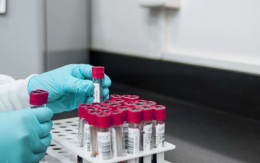 Bär & Karrer Advises Swedish Orphan Biovitrum AB in the Acquisition of emapalumab